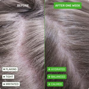 PDP_SCALP-HEALTH-Shampoo_ETHIQUE_2000x2000_02_29bf2eb8-f14f-4714-a74e-fac9464b40f4