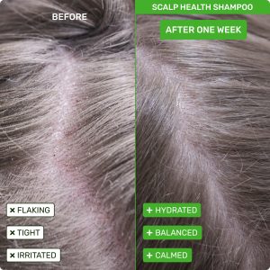 PDP_SCALP-HEALTH-Virtual-Bundle_ETHIQUE_2000x2000_01_0b093f67-fd71-4466-a162-6da9ca44c627